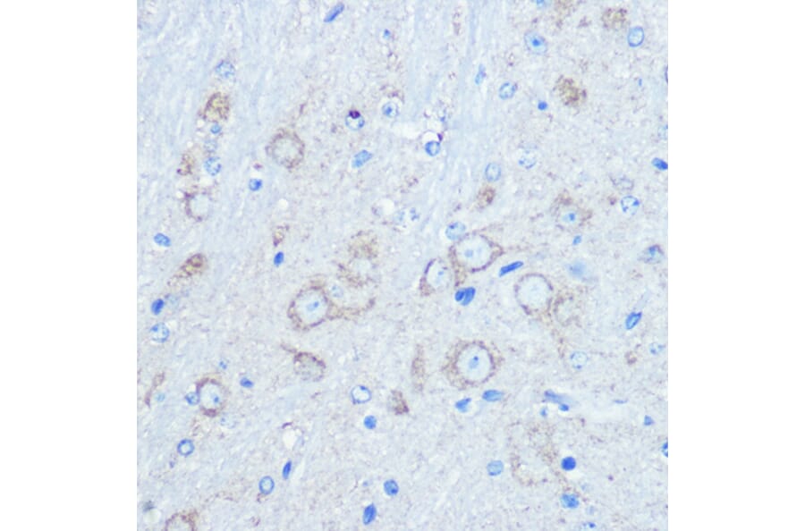 Immunohistochemistry - Anti-LC3B Antibody (A80400) - Antibodies.com