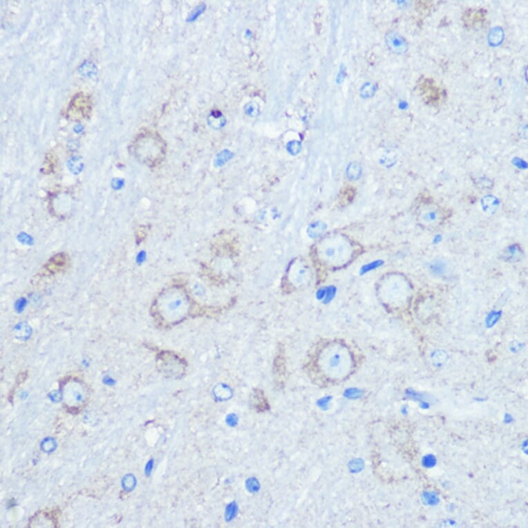 Immunohistochemistry - Anti-LC3B Antibody (A80400) - Antibodies.com