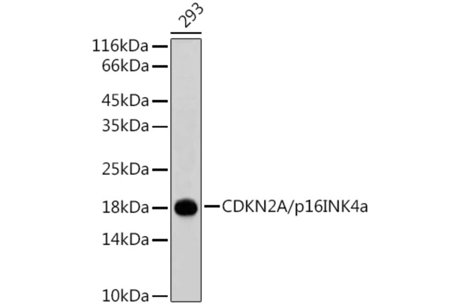 Western Blot - Anti-CDKN2A/p16INK4aF Antibody (A80401) - Antibodies.com