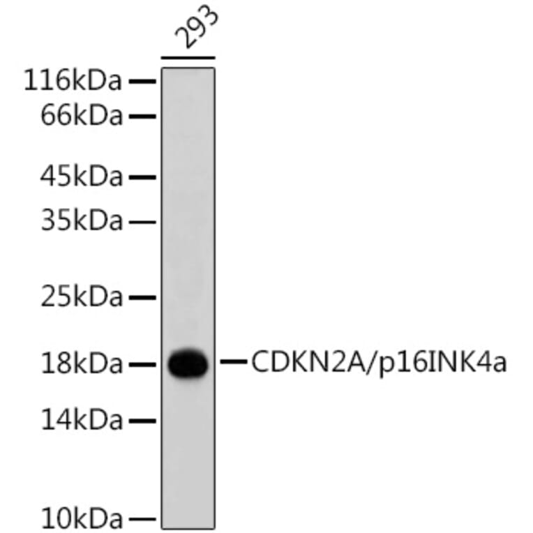 Western Blot - Anti-CDKN2A/p16INK4aF Antibody (A80401) - Antibodies.com