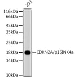 Western Blot - Anti-CDKN2A/p16INK4aF Antibody (A80401) - Antibodies.com