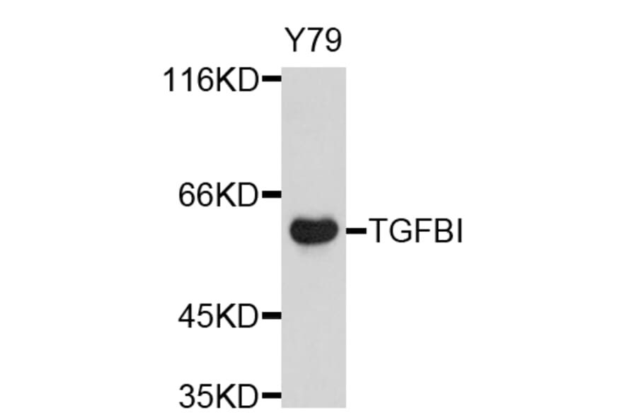Western Blot - Anti-TGFBI Antibody (A11916) - Antibodies.com