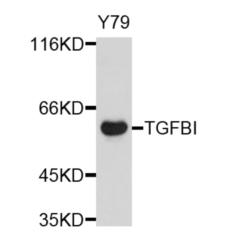 Western Blot - Anti-TGFBI Antibody (A11916) - Antibodies.com