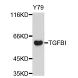 Western Blot - Anti-TGFBI Antibody (A11916) - Antibodies.com