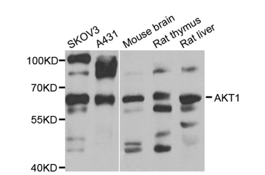 Western Blot - Anti-AKT1 Antibody (A11915) - Antibodies.com
