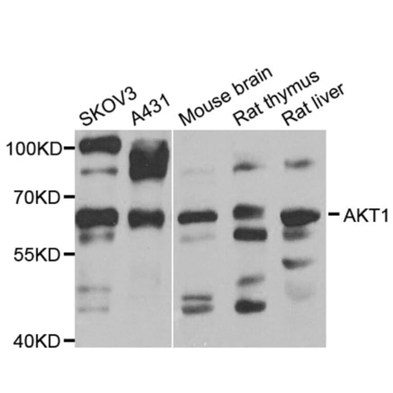 Western Blot - Anti-AKT1 Antibody (A11915) - Antibodies.com
