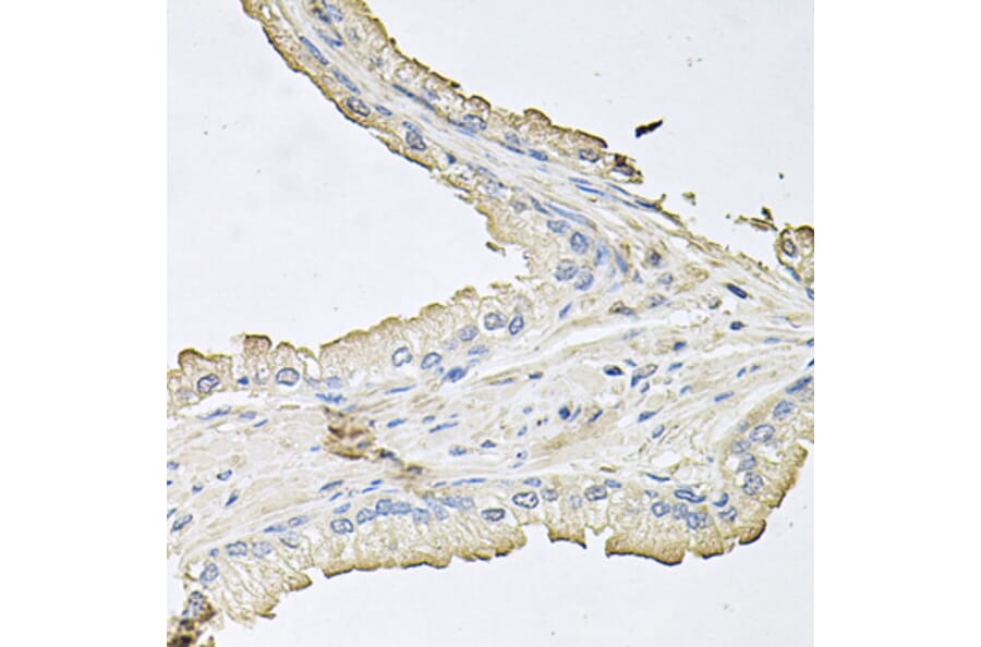 Immunohistochemistry - Anti-AKT1 Antibody (A11915) - Antibodies.com