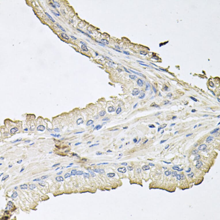 Immunohistochemistry - Anti-AKT1 Antibody (A11915) - Antibodies.com