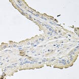 Immunohistochemistry - Anti-AKT1 Antibody (A11915) - Antibodies.com