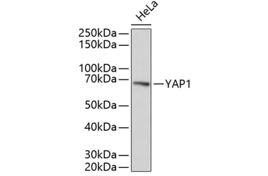 Western Blot - Anti-YAP1 Antibody (A11918) - Antibodies.com