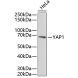 Western Blot - Anti-YAP1 Antibody (A11918) - Antibodies.com
