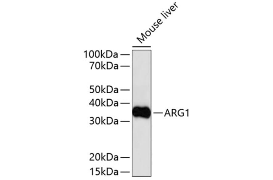 Western Blot - Anti-ARG1 Antibody (A11925) - Antibodies.com