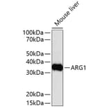 Western Blot - Anti-ARG1 Antibody (A11925) - Antibodies.com