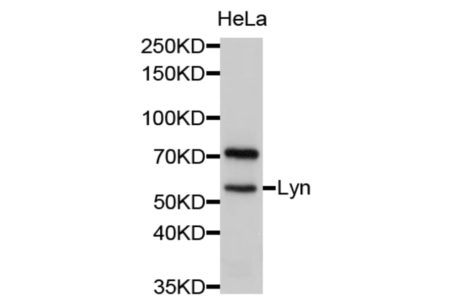 Western Blot - Anti-Lyn Antibody (A11927) - Antibodies.com