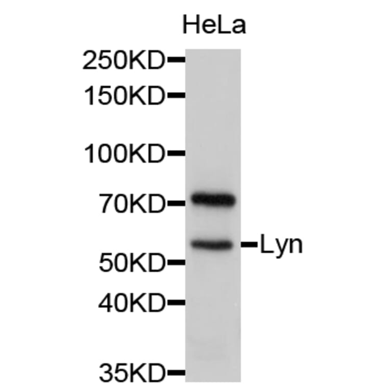 Western Blot - Anti-Lyn Antibody (A11927) - Antibodies.com