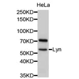 Western Blot - Anti-Lyn Antibody (A11927) - Antibodies.com