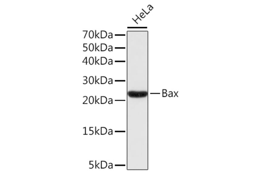 Western Blot - Anti-Bax Antibody (A80410) - Antibodies.com