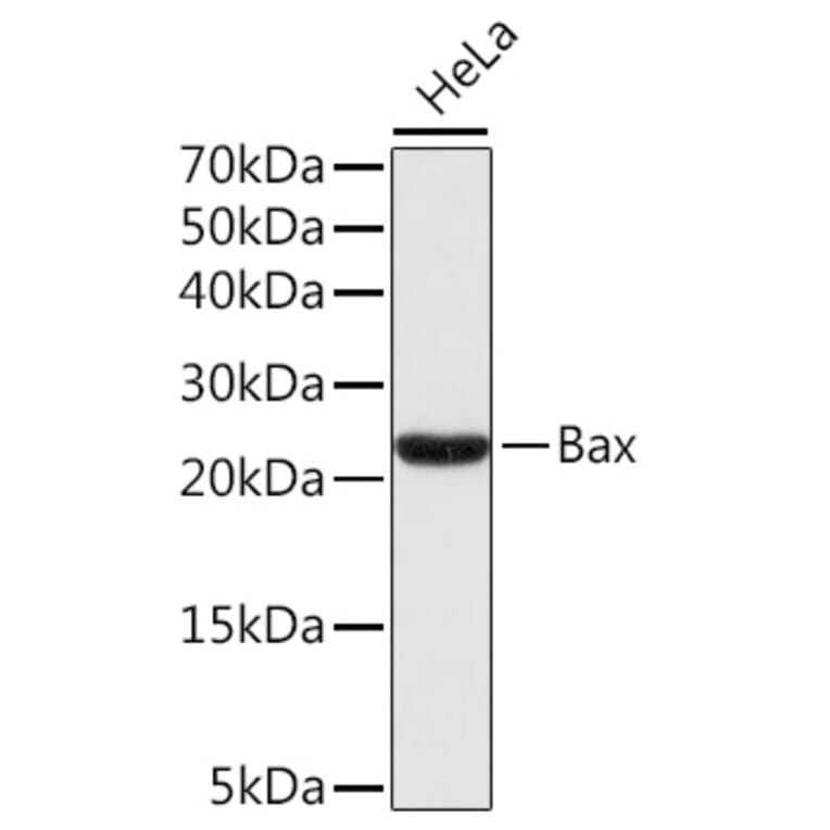 Western Blot - Anti-Bax Antibody (A80410) - Antibodies.com