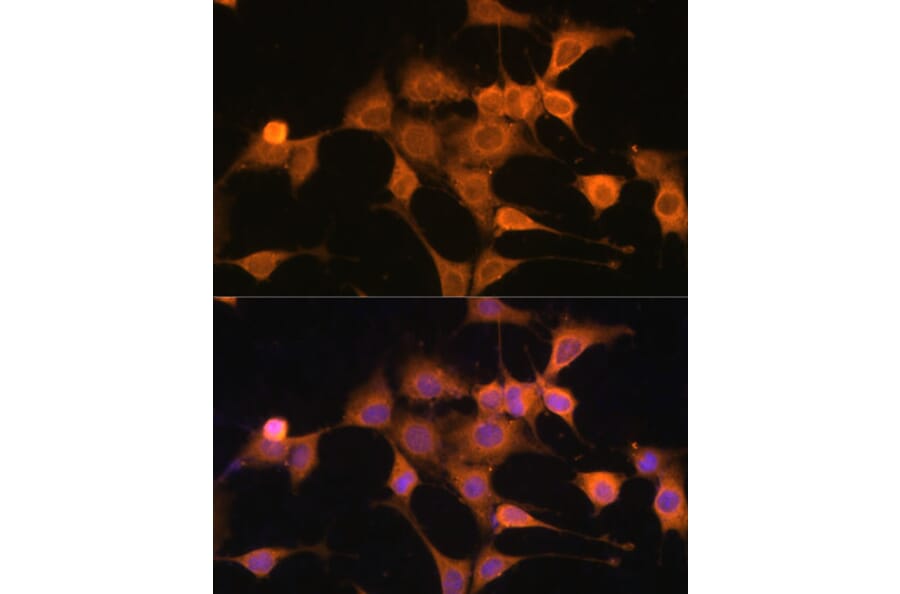 Immunofluorescence - Anti-Bax Antibody (A80410) - Antibodies.com