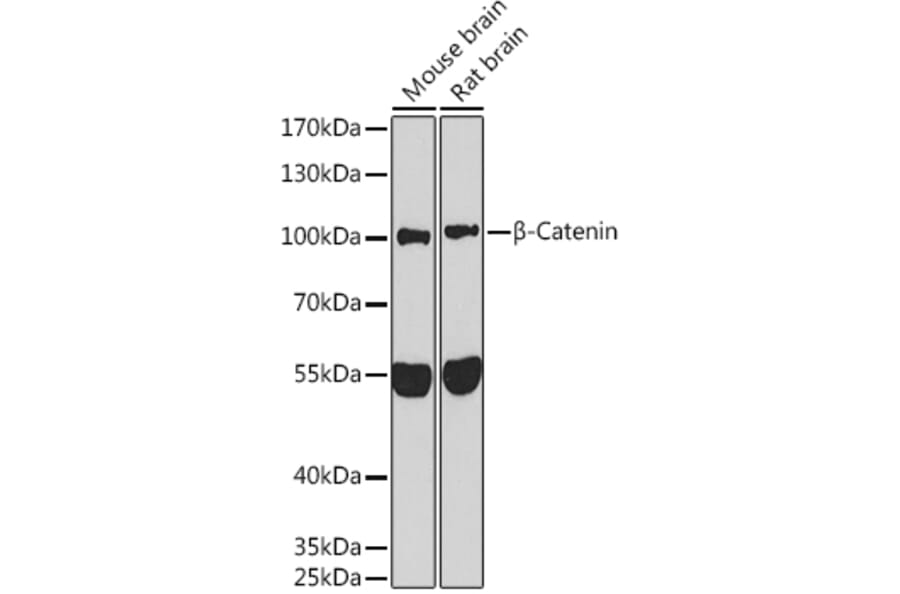 Western Blot - Anti-beta Catenin Antibody (A80413) - Antibodies.com