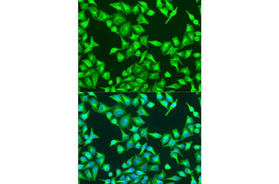 Immunofluorescence - Anti-beta Catenin Antibody (A80413) - Antibodies.com