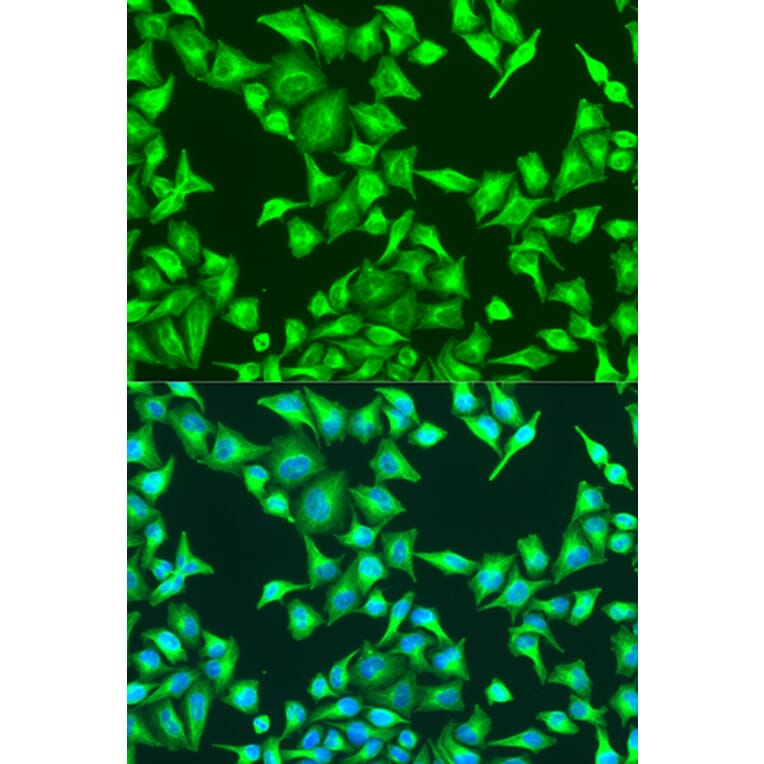 Immunofluorescence - Anti-beta Catenin Antibody (A80413) - Antibodies.com
