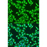 Immunofluorescence - Anti-beta Catenin Antibody (A80413) - Antibodies.com