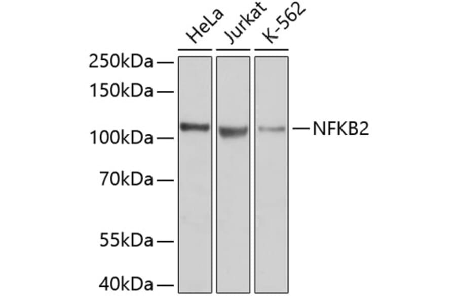 Western Blot - Anti-NFKB2 Antibody (A11917) - Antibodies.com