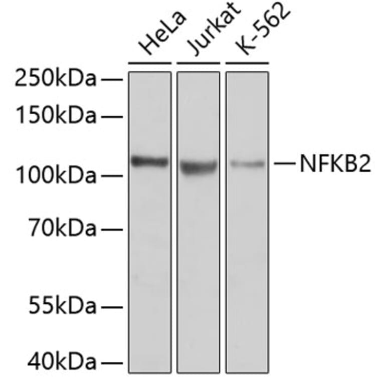 Western Blot - Anti-NFKB2 Antibody (A11917) - Antibodies.com