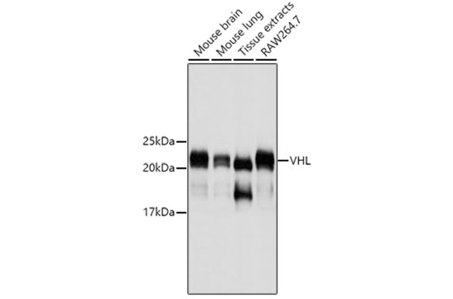 Western Blot - Anti-VHL Antibody (A11872) - Antibodies.com