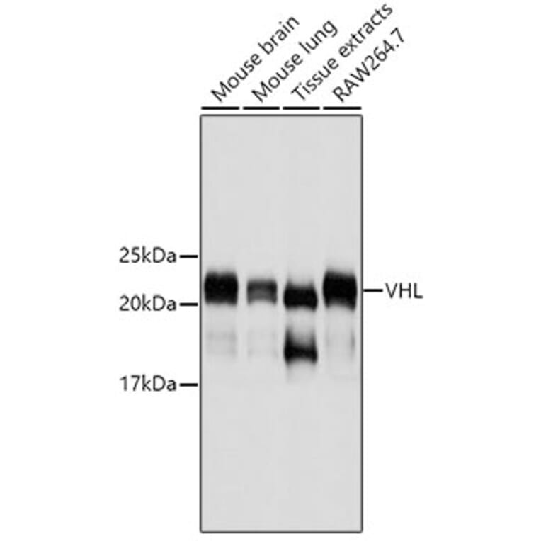 Western Blot - Anti-VHL Antibody (A11872) - Antibodies.com