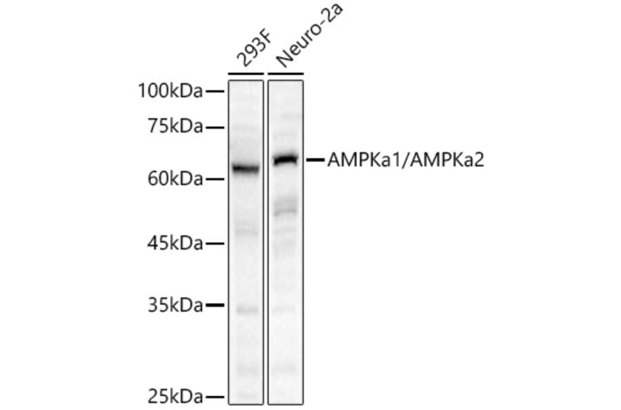 Western Blot - Anti-AMPK alpha 1 +AMPK alpha 2 Antibody (A80422) - Antibodies.com