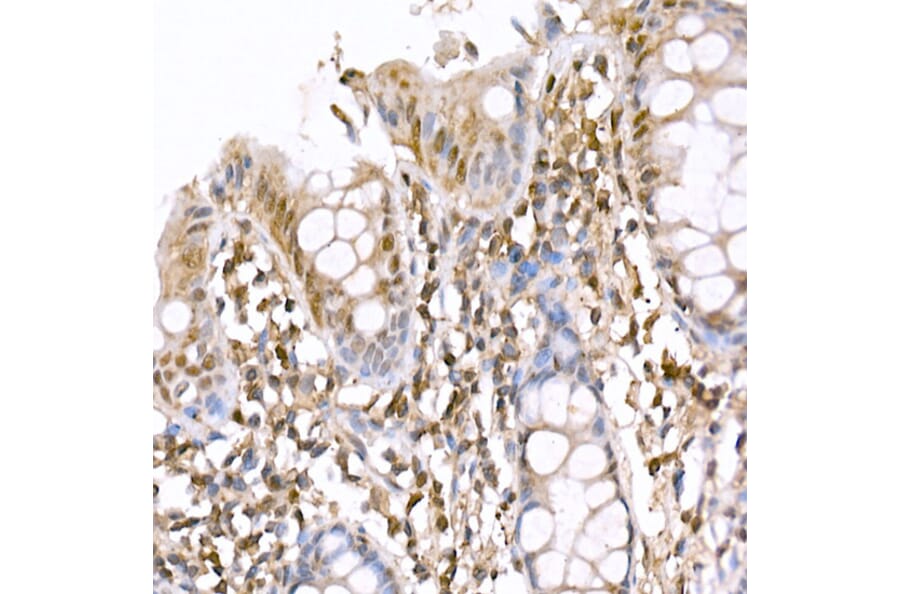 Immunohistochemistry - Anti-AMPK alpha 1 +AMPK alpha 2 Antibody (A80422) - Antibodies.com