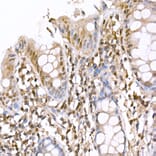 Immunohistochemistry - Anti-AMPK alpha 1 +AMPK alpha 2 Antibody (A80422) - Antibodies.com