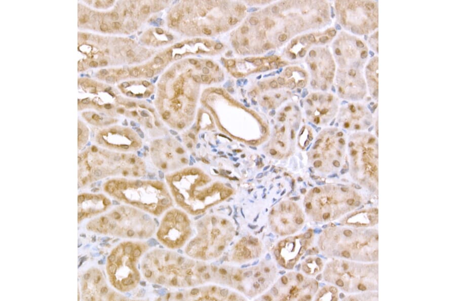 Immunohistochemistry - Anti-AMPK alpha 1 +AMPK alpha 2 Antibody (A80422) - Antibodies.com