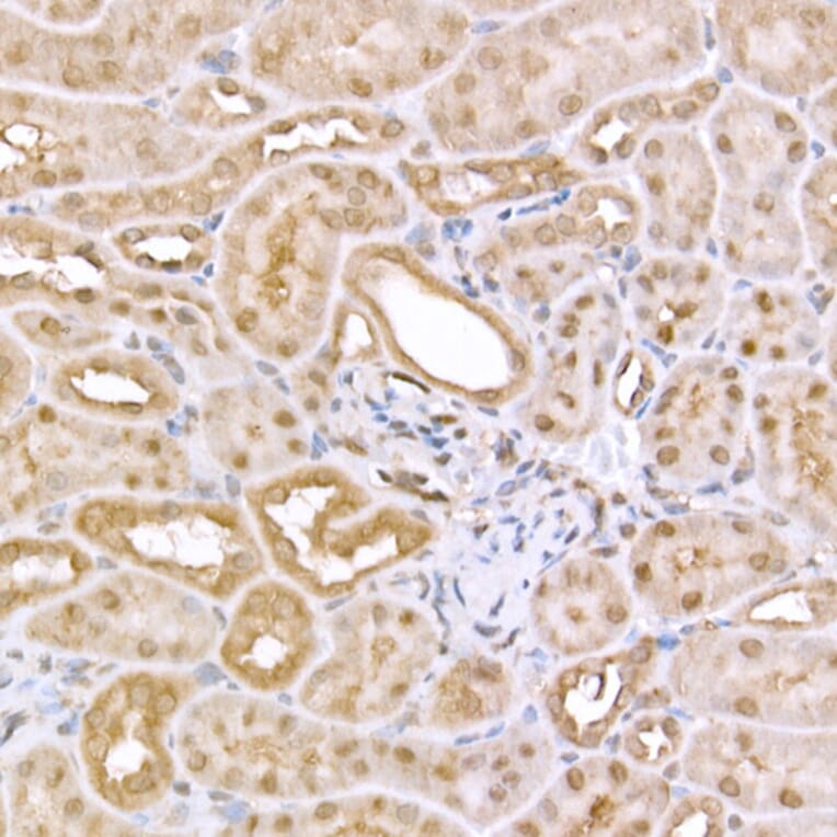 Immunohistochemistry - Anti-AMPK alpha 1 +AMPK alpha 2 Antibody (A80422) - Antibodies.com