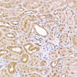 Immunohistochemistry - Anti-AMPK alpha 1 +AMPK alpha 2 Antibody (A80422) - Antibodies.com