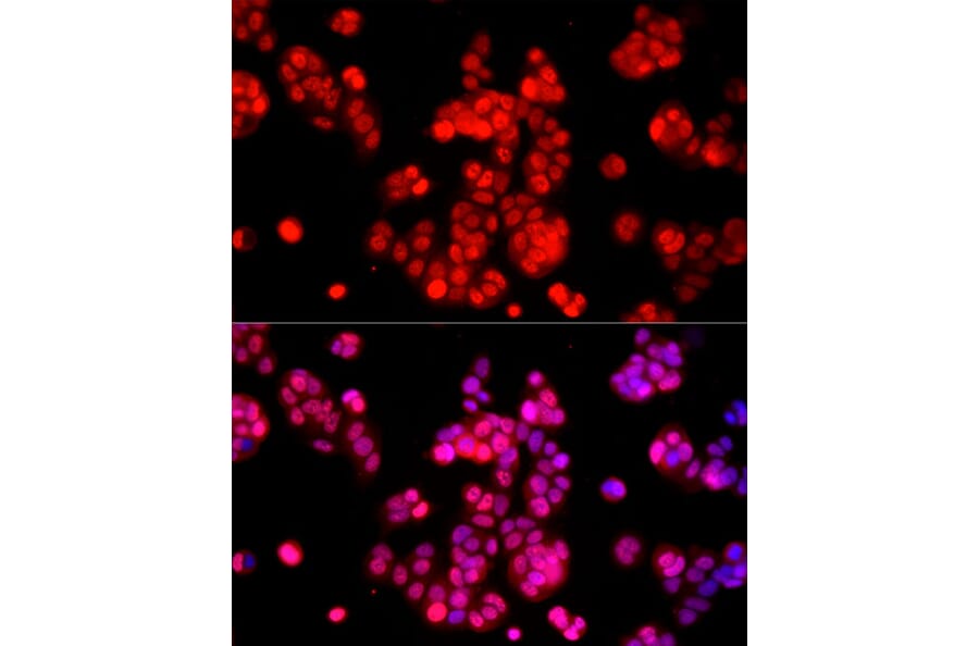 Immunofluorescence - Anti-AMPK alpha 1 +AMPK alpha 2 Antibody (A80422) - Antibodies.com