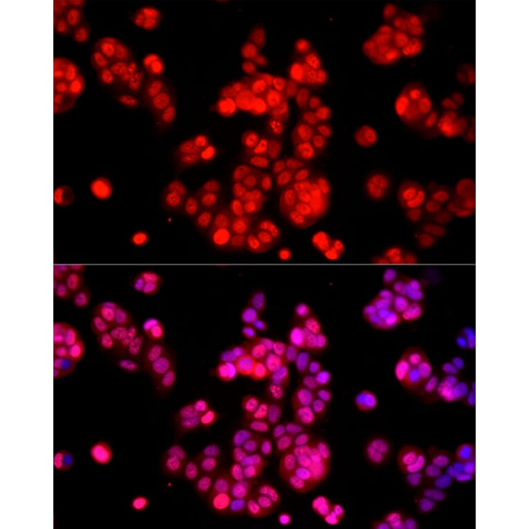 Immunofluorescence - Anti-AMPK alpha 1 +AMPK alpha 2 Antibody (A80422) - Antibodies.com