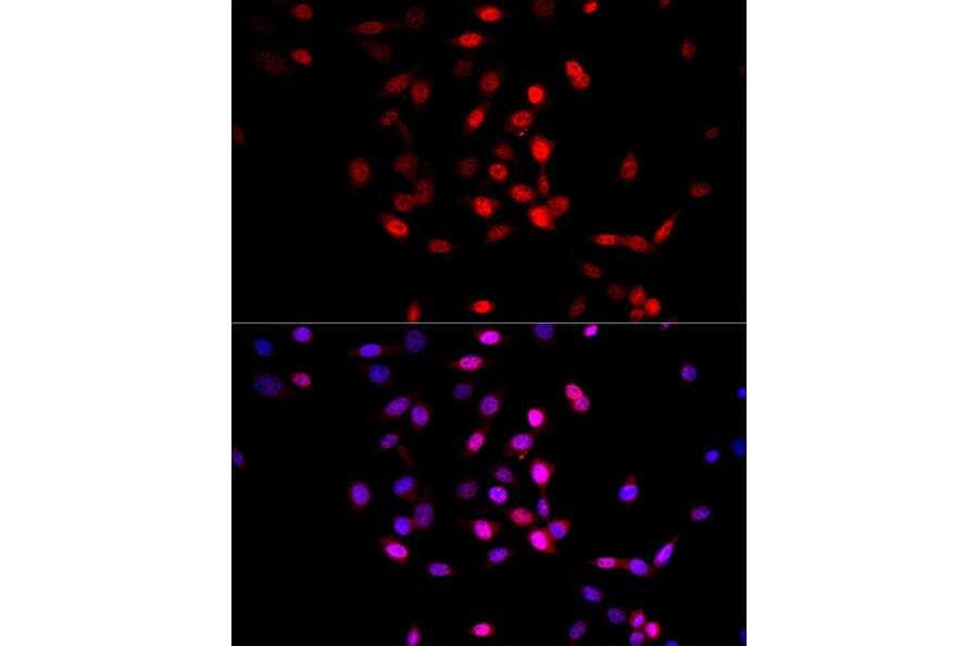 Immunofluorescence - Anti-AMPK alpha 1 +AMPK alpha 2 Antibody (A80422) - Antibodies.com