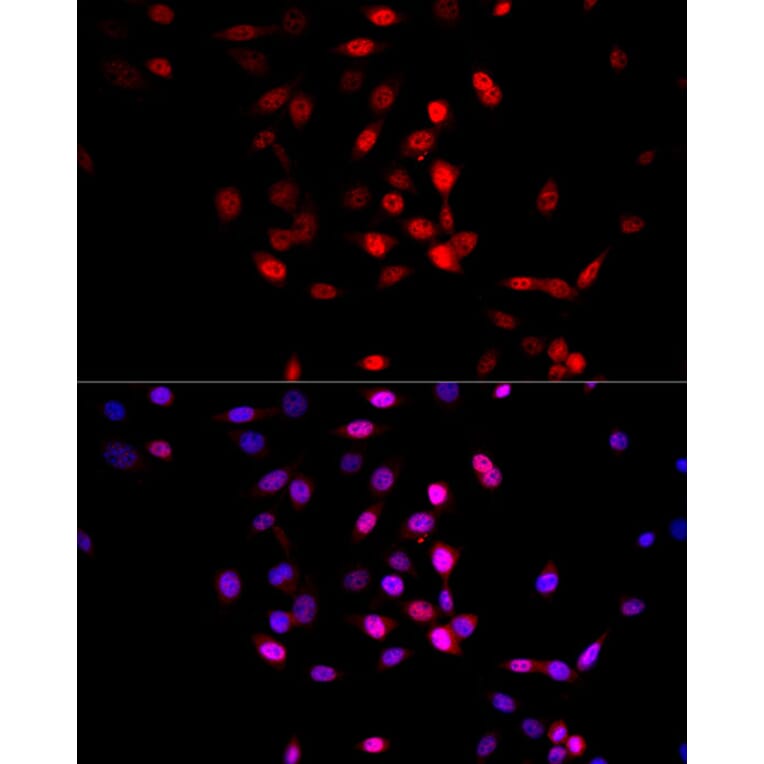 Immunofluorescence - Anti-AMPK alpha 1 +AMPK alpha 2 Antibody (A80422) - Antibodies.com