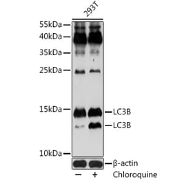 Western Blot - Anti-LC3B Antibody (A80423) - Antibodies.com