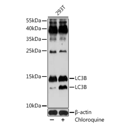 Western Blot - Anti-LC3B Antibody (A80423) - Antibodies.com