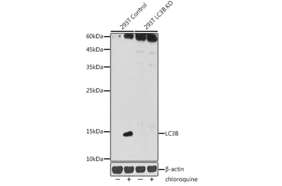 Western Blot - Anti-LC3B Antibody (A80423) - Antibodies.com