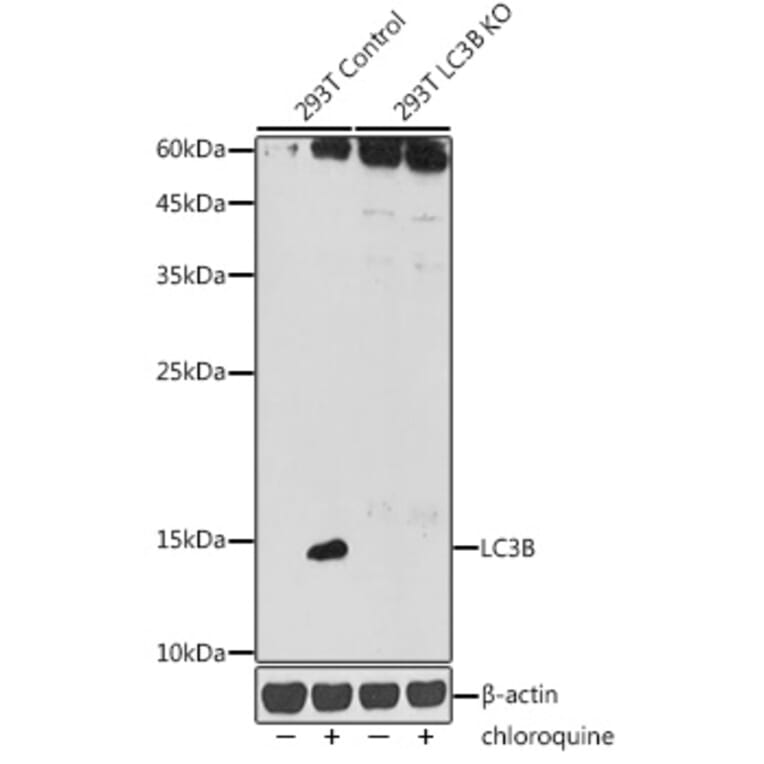 Western Blot - Anti-LC3B Antibody (A80423) - Antibodies.com