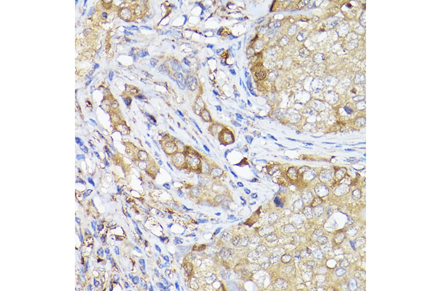 Immunohistochemistry - Anti-LC3B Antibody (A80423) - Antibodies.com