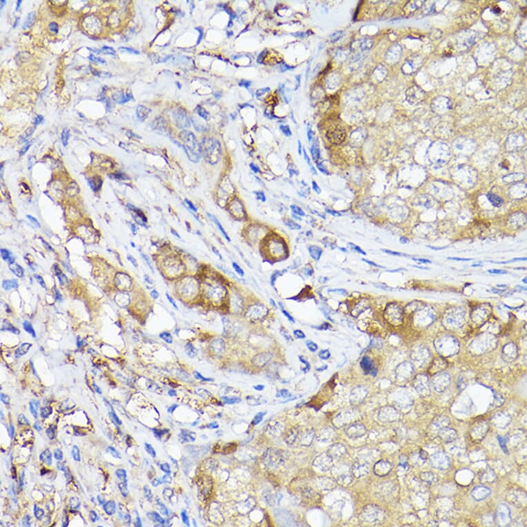 Immunohistochemistry - Anti-LC3B Antibody (A80423) - Antibodies.com