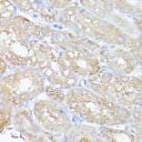 Immunohistochemistry - Anti-LC3B Antibody (A80423) - Antibodies.com