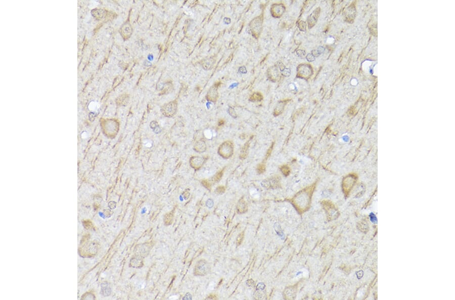 Immunohistochemistry - Anti-LC3B Antibody (A80423) - Antibodies.com