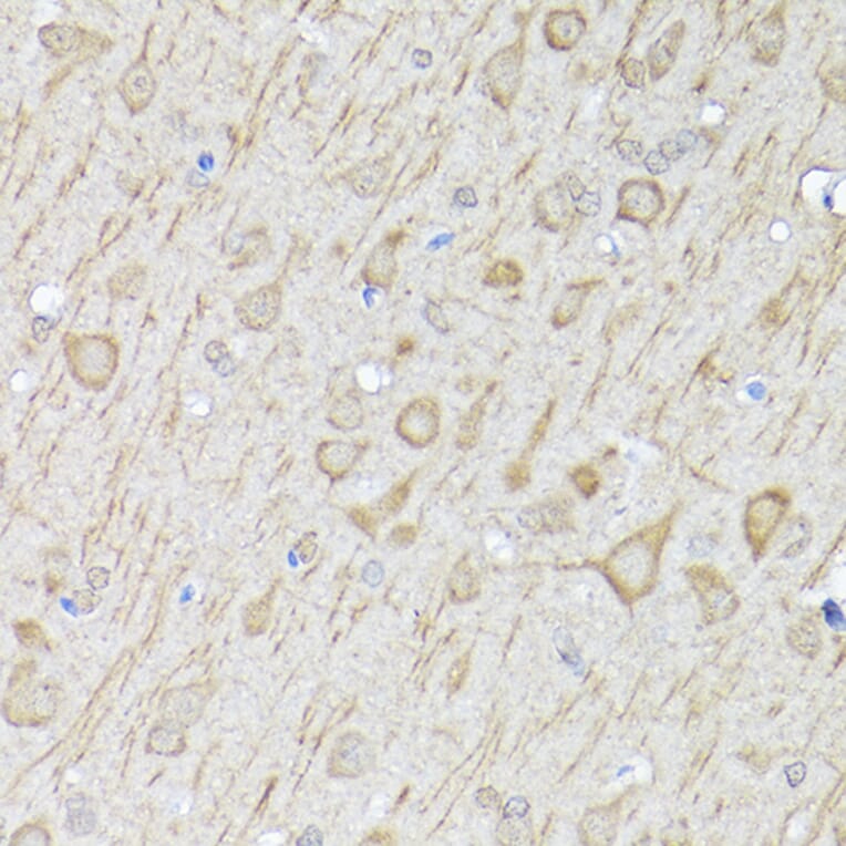 Immunohistochemistry - Anti-LC3B Antibody (A80423) - Antibodies.com